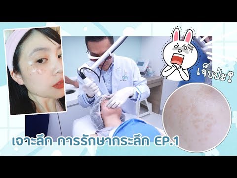 ยูริกับกระลึก Ep1 : เจาะลึกการรักษา การดูแลหลังเลเซอร์ วิธีดูชนิดของกระ | YuRi Ukuri