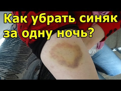 Как быстро избавиться от фингала в домашних условиях Как быстро избавиться от фингала в домашних условиях