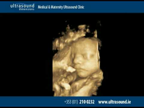 3d ultrasound scan. www.ultrasound.ie | Ultrasound Dimensions. 3D 4D Ultrasound Scan From a yawn to a stretch, or the beating of your baby#39;s heart you can take a peek at your