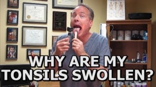 Natural Solutions For Swollen Tonsils. How To Avoid A Tonsillectomy (Common Sense Medicine)