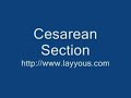 Cesarean Section