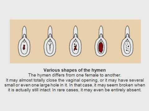 Sexology: The Hymen - Myths and Misconceptions - YouTube