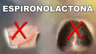 ESPIRONOLACTONA: ¿solución ACNÉ y ALOPECIA femenina?