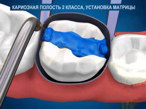 Массаж простаты - отзывы мужчин и врачей Купить товары для собак
