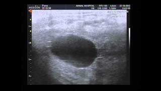 Panu Twin P 15 D Squeeze Technique 2015 10 22 14 10 55