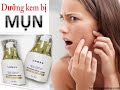 Tránh MỤN nổi da xấu nếu không biết sử dụng kem face lodas lotion,Lưu ý cần biết nếu muốn dùng lodas