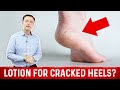 Why Lotion Never Fixes Cracked Heels and Dry Feet – Dr.Berg