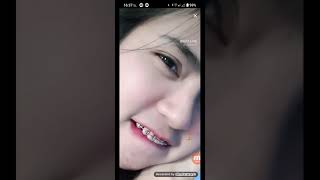Beautiful Face Bigo 1401