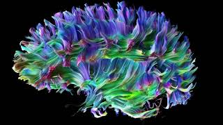 Cardiff University Brain Research Imaging Centre u2013 Diffusion of Axons 1080p Cardiff University Brain Research Imaging Centre u2013 Diffusion of Axons 1080p