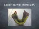 Simplified dental impressions.