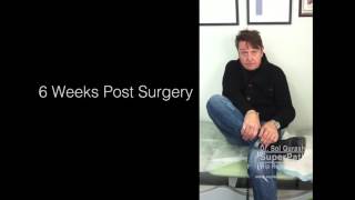 Hip Replacement Recovery Results 6 Weeks Post Surgery