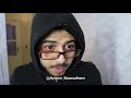 فاش امك كاتكون مريضة