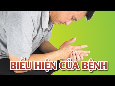 Biểu hiện của bệnh gút như thế nào?