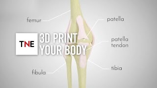 Replacing body parts with 3D printing: how one company is bringing hope to patients across the globe