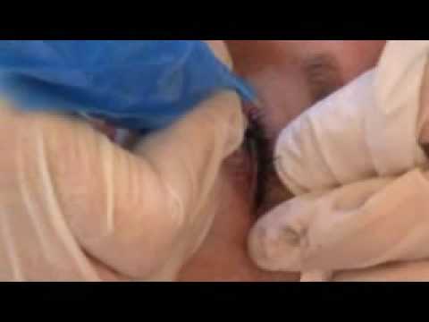 Gaby Malcangio, of SDpermanentmakeup.com performs a permanent eyeliner and 