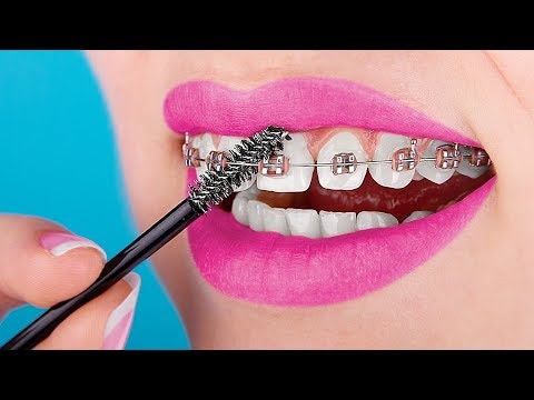 15 Crazy Braces Life Hacks You Need To Know About - YouTube