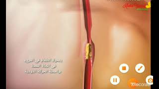 Digestive System Is Down Sausages Stomach Small Intestine Wolves To The Small Intestine Large Int