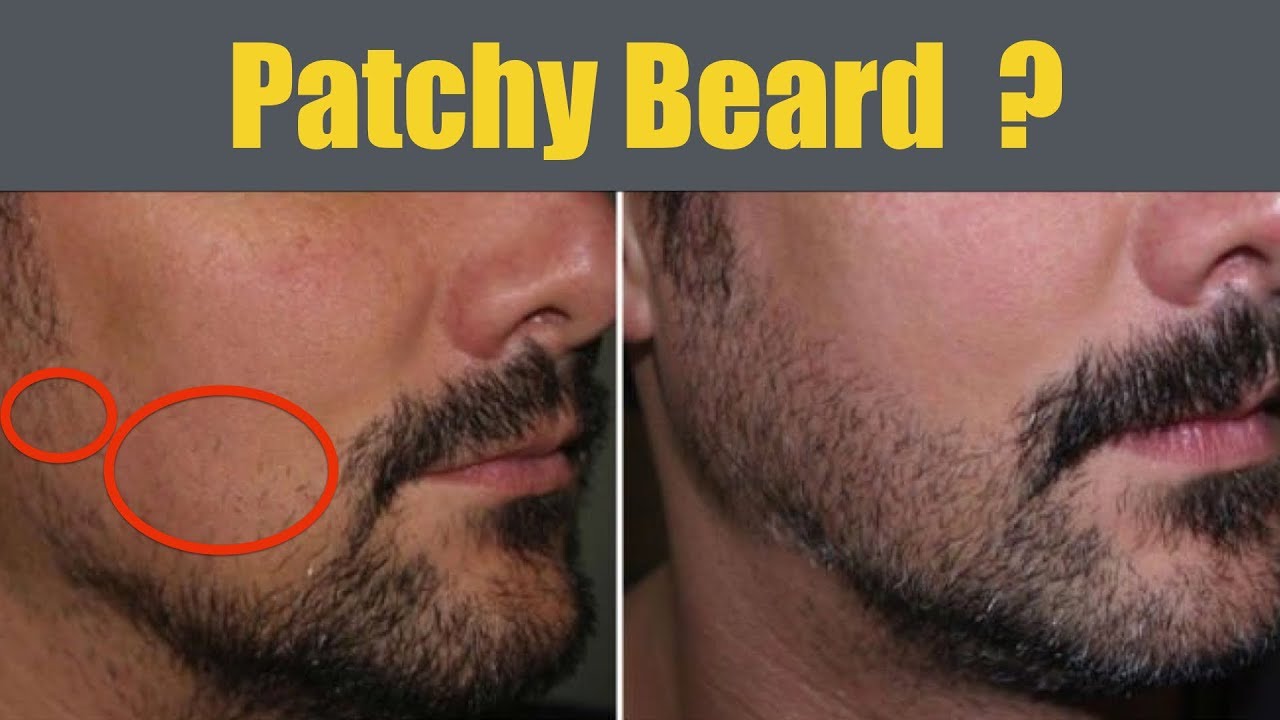 Facial hair growing enhancement