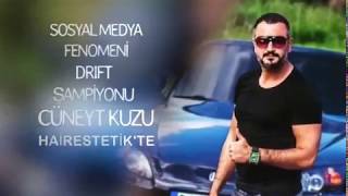 Cüneyt KUZU Engin Sönmez Saç Ekimi