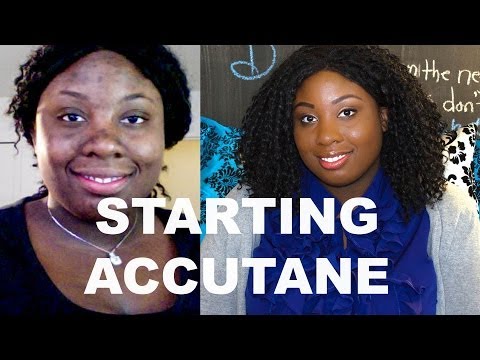 Accutane 30 Day Wait