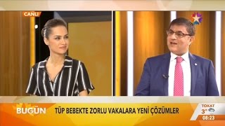 Tüp bebek ve yeni tedavi yöntemleri -  Bugün (Star TV)