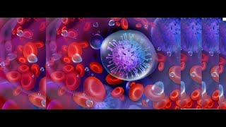 Quick Review Hematological Malignancies
