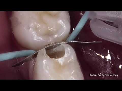 Waterlase Videos