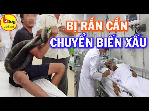 Sức khoẻ người đàn ông bị rắn hổ mang chúa cắn chuyển biến nặng