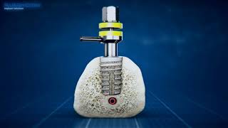 Pyramidion ultra short implant system