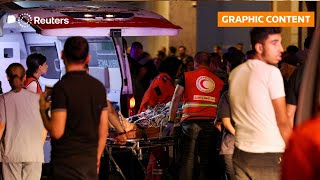 Graphic Content Warning A Year On, Pager Blasts Haunt Lebanons Maimed Survivors Reuters