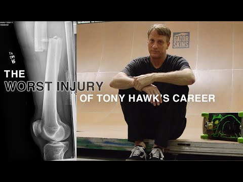 Tony Hawk Breaks Down The Worst Injury Of His Career
