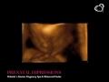ultrasound 3d 4d