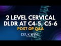 POST OP - 2 Level Deuk Laser Disc Repair at C4-5, C5-6 of the Cervical Spine