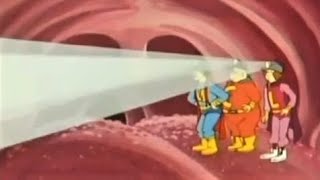 Inside A Gorillas Mouth Trs E26