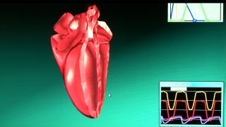 Real-Time Heart Beat Simulator Visualizes Pulsation And Disease On A Laptop Pc