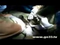 YouTube Cebu doctors scandal
