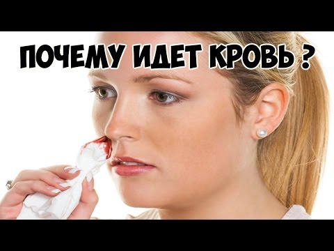Почему из левой ноздри идет кровь Почему из левой ноздри идет кровь
