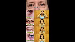 Eye Yoga For Bright & Healthy Eyes Siddhi Yoga