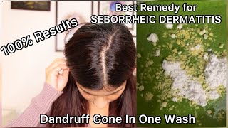 Maintenance For Seborrheic Dermais Dandruff Current Scalp Situation Seborrheic Dermais Diet