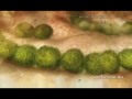 "Immune" Documentary - Part 6 - B Cells & Antibody Release