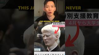 This Japanese Albino Never Expected A Normal Life