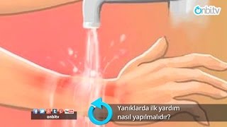 Yanıklarda ilk yardım nasıl yapılır? #yanıklardaneyapılır #yanıklardailkyardım #