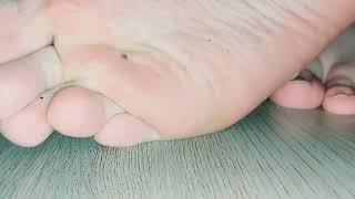 Squishing A Speck-Sized Clay Ball