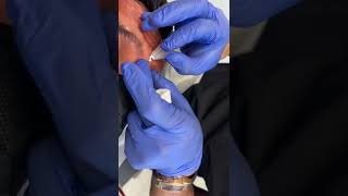 Smooth Threads For Deep 11 Lines By Dr.tsay - Ageless Md