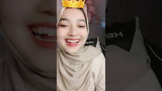 Liveig Secondminit-Live Streaming