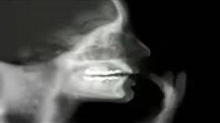 Watch Canon Master video
