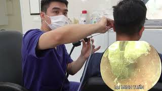 Nấm Ống Tai Phần 7 Bs Lại Minh Tuấn