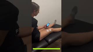 Neuromuscular Electrical Stimulation Nmes