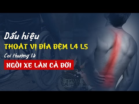 5 Dấu Hiệu Thoát Vị Đĩa Đệm Cột Sống Thắt Lưng L3L4L5. 99% Bệnh Nhân Bỏ Qua Rồi Hối Hận Không Kịp