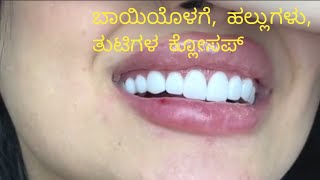 Females Teeth Inside The Mouth Smile Makeover